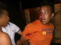 Edi yang babak belur setelah dihajar massa